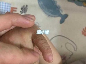 宝宝这才三根手指就流,宝宝这才三根手指就流了好多水，这是怎么回事呢？